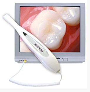 Intraoral Camera  Digital  Image  Technology